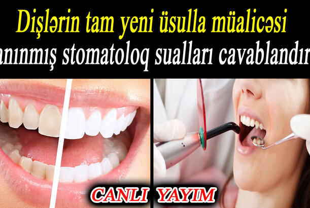 Dişlərin tam yeni üsulla müalicəsi - Tanınmış stomatoloq sualları cavablandırır