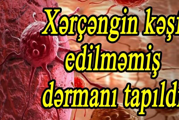 Xərçəngin kəşf edilməmiş dərmanı tapıldı - Onkoloq-cərrah İbrahim Əsədli təfərrüatları açıqlayır