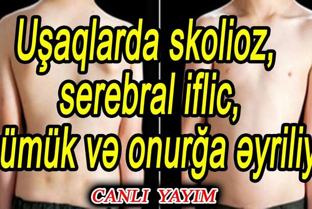 Uşaqlarda skolioz, serebral iflic, sümük və onurğa əyriliyi