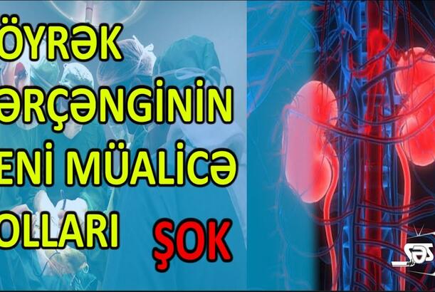 Böyrək xərçənginin yeni müalicə yolları açıqlandı - ŞOK