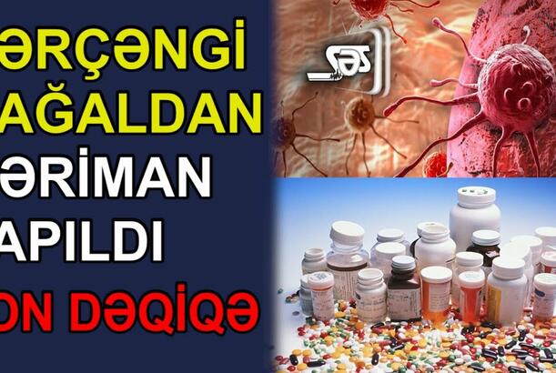 Xərçəngi sağaldan dərman tapıldı - Həkim yeni üsul kəşf etdi