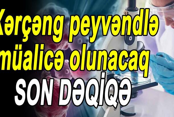 Xərçəng peyvəndlə müalicə olunacaq - Kimyaterapiyaya alternativ tapıldı