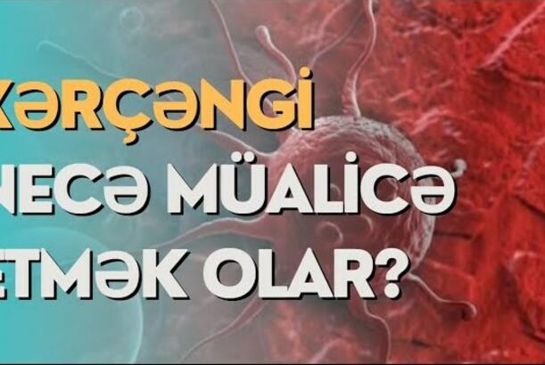 Xərçəngi necə müalicə etmək olar? - Ən effektiv üsullar