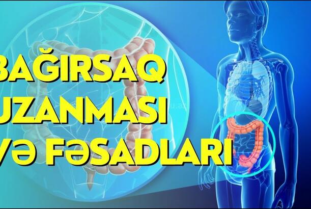 Bağırsaq uzanması və fəsadları - həkim İlqar Alışov sualları cavablandırır