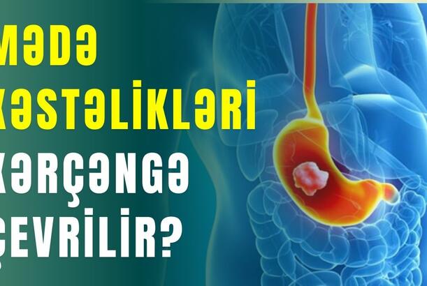 Mədə-bağırsaq xəstəliklərini yaradan əsas səbəblər