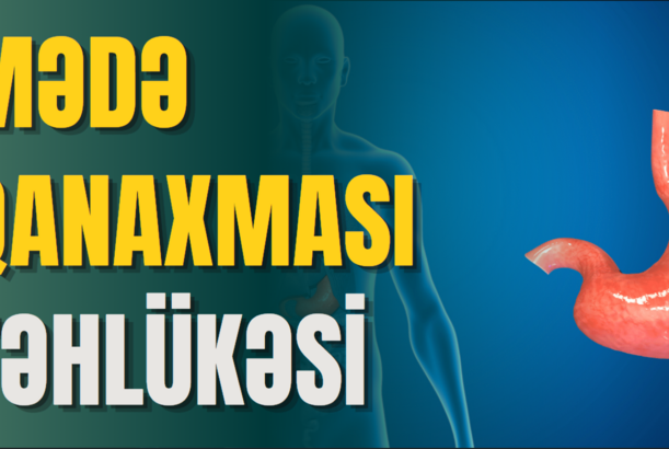Mədə qanaxmasının əlamətləri və müalicəsi