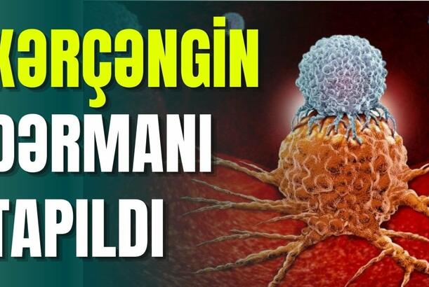 Xərçəngin dərmanı tapıldı – Hamı bunu gözləyirdi