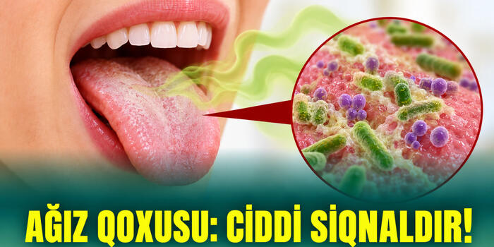 Ağız Qoxusu: Ciddi Siqnaldır